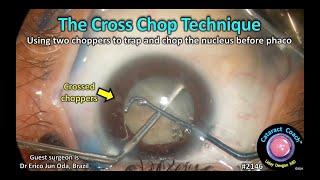 CataractCoach™ 2146: the cross chop technique