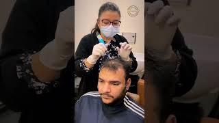 Mesogrow is the best treatment to get rid of hair fall | #hairfallcontrol #Shorts #youtubeshorts