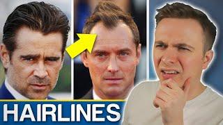 Widows Peak VS Receding Hairline - Should You Be Worried?