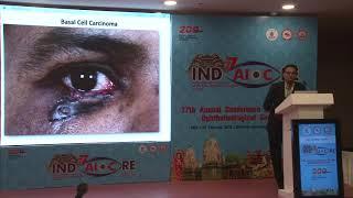 AIOC2019   IC388   Topic   Recent advances in treatment   Dr Sumeet lahane