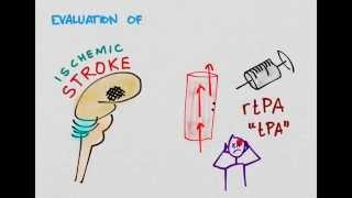 Ischemic Stroke 03: Evaluation