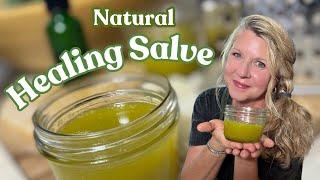 How to Make a Natural Comfrey Salve That  Works