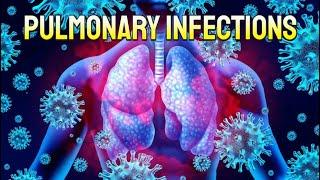 Pneumonia and Respiratory Infections (updated 2023) - CRASH! Medical Review Series