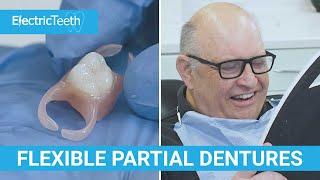 Flexible dentures & false teeth explained