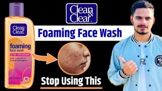 Clean & Clear Foaming Face Wash Review | Side Effects | Benefits | Ingredients & How To Use ?