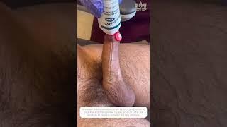 Penis Shockwave Therapy for Harder Erections