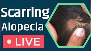 What is Scarring Alopecia? Solution Of Scarring Alopecia!6