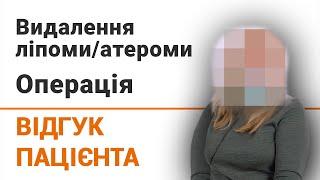 Видалення ліпоми / атероми. Операція - відгук пацієнтки клініки Добрий Прогноз