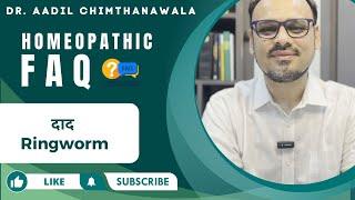 दाद | Ringworm | Homeopathy FAQ with Dr. Aadil