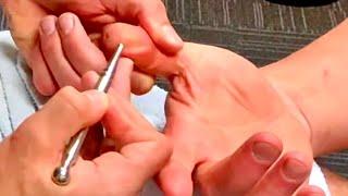 Deep hand reflexology massage using tools such as acupressure pen. Josh massaging Brandon part 6.