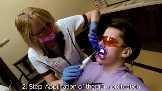 Bleaching with Biolase Laser, snow-white teeth in 20 minutes! Dental Clinic Hungary, Diamant-Dent