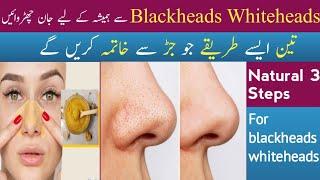 Home Remedies for Blackheads | Nose blackheads Remove | Get Clear Skin  #skincare ##blackheads