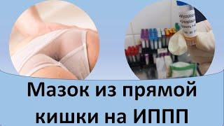 Мазок из прямой кишки на ИППП