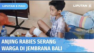 Sejumlah Warga Jembrana Bali Jadi Korban Gigitan Anjing yang Diduga Rabies | Liputan 6