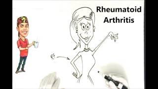 Rheumatoid Arthritis Explained Simply