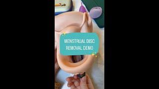 Quick menstrual disc removal demo 