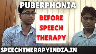 SLP Sanjay Kumar: Before Puberphonia Therapy || Voice Disorder and Pitch Changes || UP || Kanpur