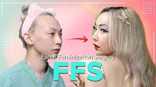 FFS review: from surgery to 60 days