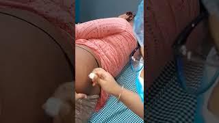 Buttock injection video | hip injection | woman buttock injection |