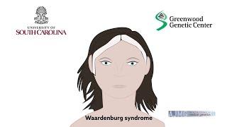 Biallelic deletions of the Waardenburg II syndrome gene, SOX10, cause a recognizable arthrogryposis