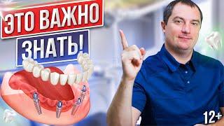 All-on-4. В каких случаях стоит выбрать методику All on 4 - протезирование на ЧЕТЫРЕХ имплантатах