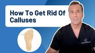 How Do You Get Rid Of Calluses Permanently?
