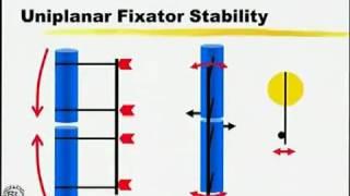 Biomechanics of Ilizarov Fixator