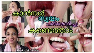 Self Examination for Mouth Cancer | Oral Cancer Screening|How to find mouth cancer at home |Dr Ajina