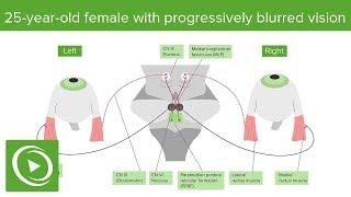 USMLE Step 1: Anatomy Question #3: Walkthrough Tutorial by DocOssareh | Lecturio