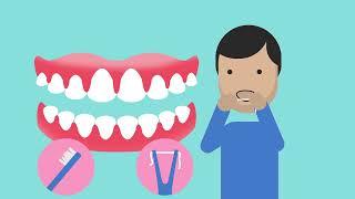 Explaining gum disease