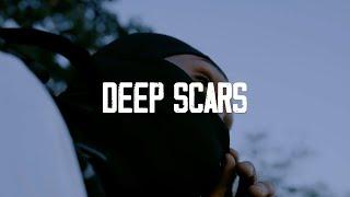 Rvssian x Skeng x 10Tik Type Beat - Deep Scars - Dancehall Instrumental 2024 (Pain)