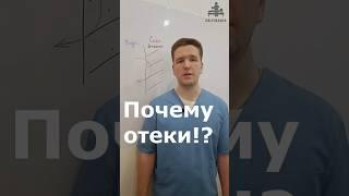 Отеки, почему возникают? Секрет прост! | Доктор Финагин