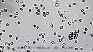 Capnocytophaga sputigena twitching motility