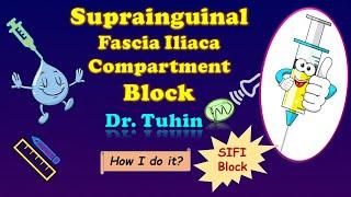 Ultrasound Scanning Principles for Suprainguinal Fascia Iliaca block | SIFI Block | S-FICB