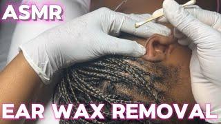 Very Detailed and Intense ASMR Ear Wax Removal & Thorough Ear Cleaning (Ear Scratching) Gum chewing