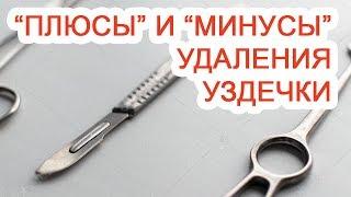 «Плюсы» и «минусы» удаления уздечки / Доктор Черепанов