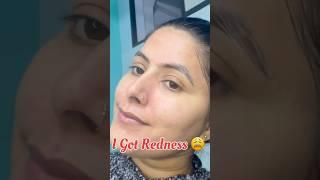 I got Redness #ytshorts #skincare #shorts