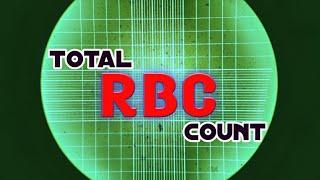 Red Blood Cell Count Test | Total RBC count | Procedure and Calculations |