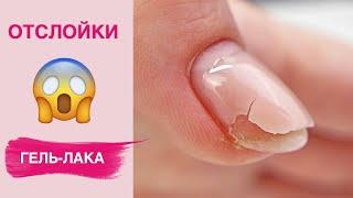 Причины отслойки гель-лака | Секреты носки маникюра