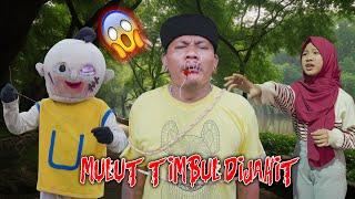 GAWAT!!! Mulut Timbul Di J4hit Sama Upin