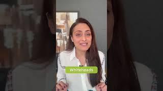 Whiteheads | treatment | affordable | dermatologist