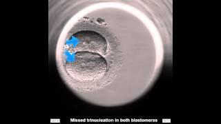 EmbryoScope Embryo Development - Trinucleation