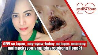 OFW fights for her life after infection from a nose surgery?! | Kapuso Mo, Jessica Soho