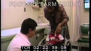 Bone Lengthening Treatment w/ Ilizarov method 250050-08 | Footage Farm