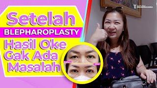 Blepharoplasty Jakarta Solusi Kelopak Mata Turun Atau Hitam