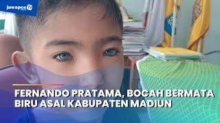 MADIUN - Fernando Pratama, Bocah Bermata Biru Asal Kabupaten Madiun