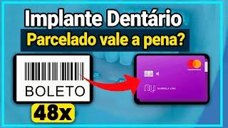 Implante Dentário PARCELADO vale a pena? Boleto ou Cartão QUAL O MELHOR?