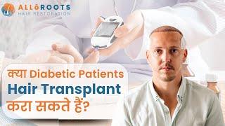 Can diabetic patients undergo hair transplantation? | Dr Alok Sahoo Explained in Hindi