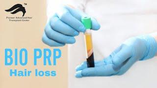 prp treatment in bangalore | best cost results treatment for Hair loss  treatment Bangalore, India