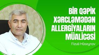 Bir qəpik xərcləmədən Allergiyayaların müalicəsi | Fizuli Hüseynov